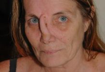 ‘We’ll fix your face’