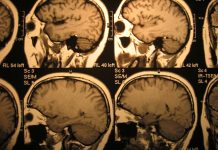 Concerns over cost of screens