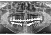 Dental and mental: Deakin draws new links