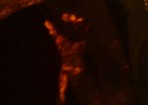 sophie ultrasound