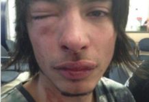 CBD outrage: Kicked in the face by gutless thug