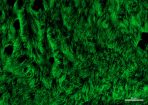 CSIRO – cilia on lab-grown ciliated cells, stained green for visualisation